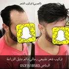 بديل الزراعة