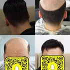تركيب شعر طبيعي