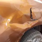 شفط وتعديل بدون صبغ