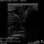 فحص سونار للاغنام والماعز