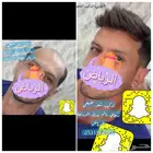 تركيب شعر بوستيجه ويج رجالي