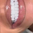 ابتسامة متحركة