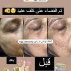 كريمات تبييض البشرة