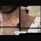 كريمات تبييض البشرة