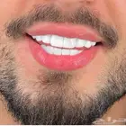 ابتسامة هوليود