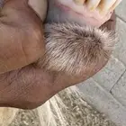 تيس عارضي