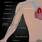 فصد عرق النسا وطريقة مسار العروق