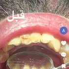 جميع العلاجات مجانا ماعدا التقويم والزراعه