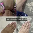 كريم تبييض البشره وازالة التصبغات