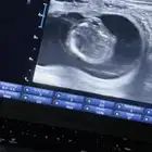 طبيب بيطري سعودي متخصص بفحص السونار ونقل الأجنه