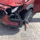 كونا صدمه خفيفه