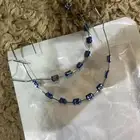 تقويم أسنان