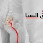 معالج شعبي لي علاج الابهر وعرق النساء والانزلاق الغظروفي