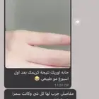 كريمات تفتيح باسبوع واحد