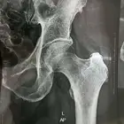 Physiotherapy Specialist at home علاج طبيعي في المنزل