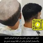 باروكات لاصقه