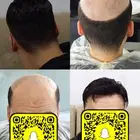 باروكات كلبسات ولصق