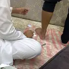 فصد عرق النسا والآم الظهر