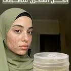 كريم تبييض البشره وازالة التصبغات