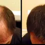 منتج تجميلي رهيب لإخفاء الصلع