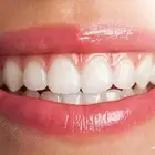علاج اسنان مجاني