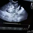 كشف الحمل للأغنام والماعز بالسونار