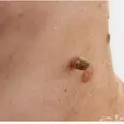 جهاز لي ايزاله  اثأليل