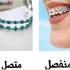 تقويم اسنان زينه