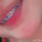 تقويم اسنان زينة تقويم اسنان زينه ب 39  عرض