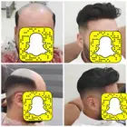 تركيب شعر بشري طبييعي لصق رجالي