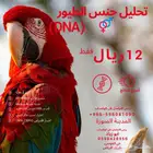 خدمة تحليل الطيور (تحليل DNA) لتحديد جنس الطيور