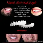 للبيع تلبيسات اسنان تجميلية