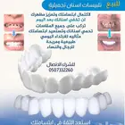 للبيع تلبيسات اسنان تجميلية