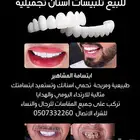 للبيع تلبيسات اسنان تجميلية