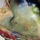 لؤلؤه طبيعيه نادره(ليسة مستزرعه)