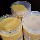 يقضي علا البواسير تمامآ بإذن الله