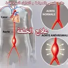 الخلعه والحجامه