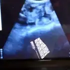 سونار للحلال