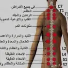 علاج طبيعي وحجامه نبويه