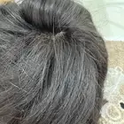 باروكة شعر