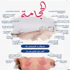 متخصص حجامة