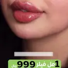 تجميل شفايف