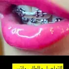 تقويم أسنان زينه